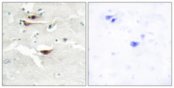 InsP5 2-kinase rabbit pAb