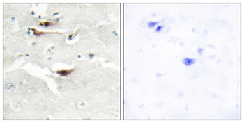 InsP5 2-kinase antibody