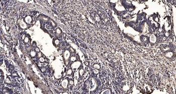 NBEAL1 rabbit pAb