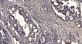 NBEAL1 antibody