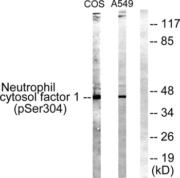 p47-phox (phospho Ser304) rabbit pAb