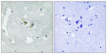 p47-phox (phospho Ser345) rabbit pAb