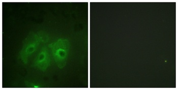 p47-phox (phospho Ser359) rabbit pAb