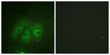 p47-phox (phospho-Ser359) antibody