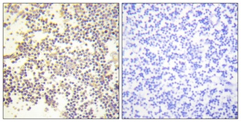 p47-phox (phospho Ser328) rabbit pAb