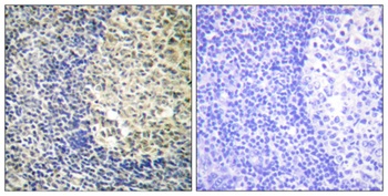 p47-phox (phospho Ser370) rabbit pAb