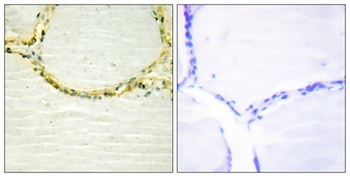 Bmx (phospho-Tyr566) antibody