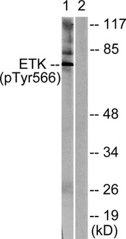 Bmx (phospho Tyr566) rabbit pAb