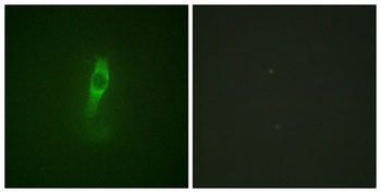 Bmx (phospho-Tyr40) antibody