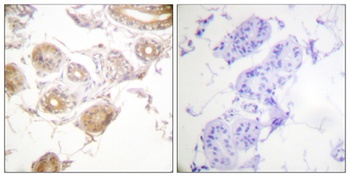 Bmx (phospho-Tyr40) antibody