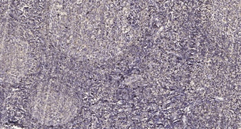 POLR3D antibody