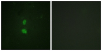 SNAI 1 (phospho Ser246) rabbit pAb