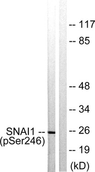 SNAI 1 (phospho Ser246) rabbit pAb