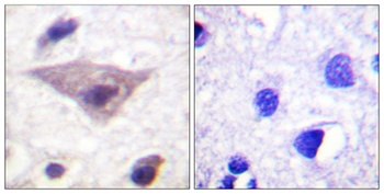 Synuclein-α (phospho Ser129) rabbit pAb Antibody