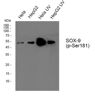 Sox-9 (phospho Ser181) rabbit pAb