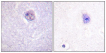 Sox-9 (phospho Ser181) rabbit pAb