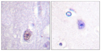 Sp1 (phospho-Thr453) antibody