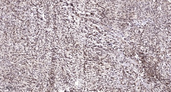 Sp3/4 antibody