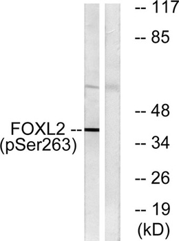 FoxL2 (phospho-Ser263) antibody