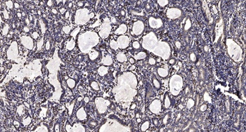 Spectrin β II rabbit pAb