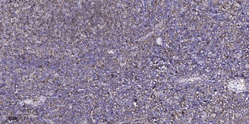 c-Src (phospho-Tyr216) antibody