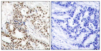BRCA1 (phospho Ser1423) rabbit pAb