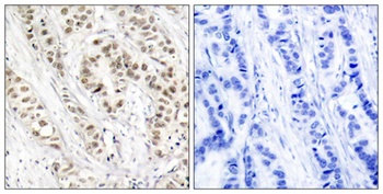 BRCA1 (phospho Ser1524) rabbit pAb