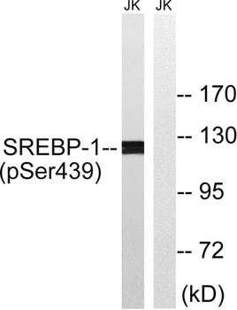 SREBP-1 (phospho Ser439) rabbit pAb