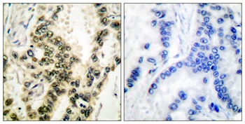 SRF (phospho Ser103) rabbit pAb