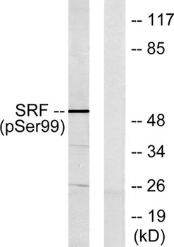 SRF (phospho-Ser103) antibody
