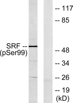 SRF (phospho Ser103) rabbit pAb
