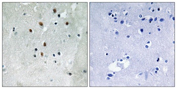 SRF (phospho Ser77) rabbit pAb