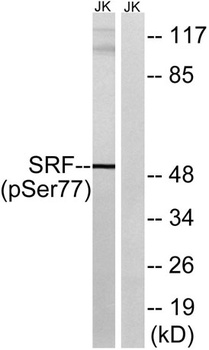 SRF (phospho Ser77) rabbit pAb