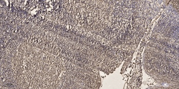 SRF (phospho Thr159) rabbit pAb