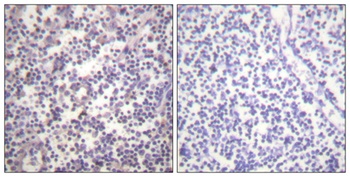 Raf-B (phospho Ser602) rabbit pAb
