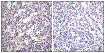 Raf-B (phospho-Ser602) antibody