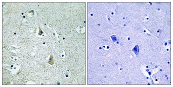 Raf-B (phospho Ser446) rabbit pAb