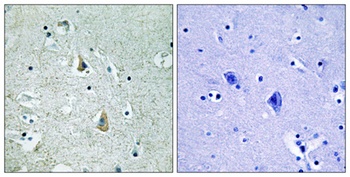 Raf-B (phospho-Ser446) antibody