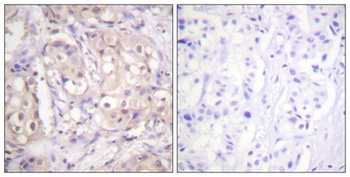 Raf-B (phospho Thr599) rabbit pAb