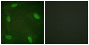 SSB (phospho Ser366) rabbit pAb