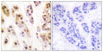 SSB (phospho Ser366) rabbit pAb