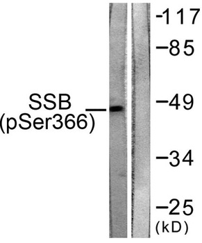 SSB (phospho Ser366) rabbit pAb