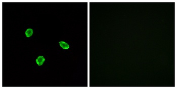 SSTR1 antibody