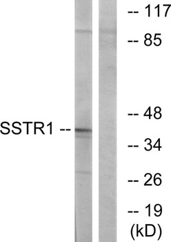 SSTR1 antibody