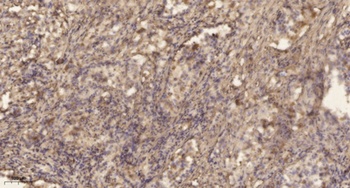TIS11B (phospho Ser92) rabbit pAb