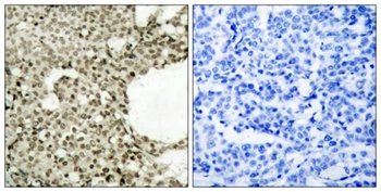 Stat1 (phospho Ser727) rabbit pAb