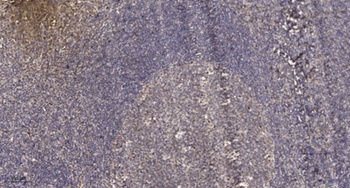 Stat2 (phospho Tyr631) rabbit pAb