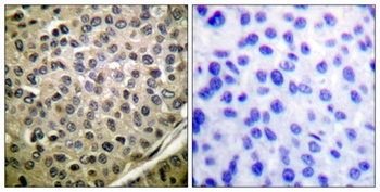 Stat4 (phospho Tyr693) rabbit pAb