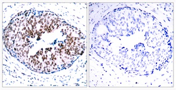 Stat5a (phospho Ser780) rabbit pAb