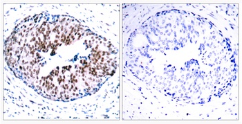 Stat5a (phospho-Ser780) antibody